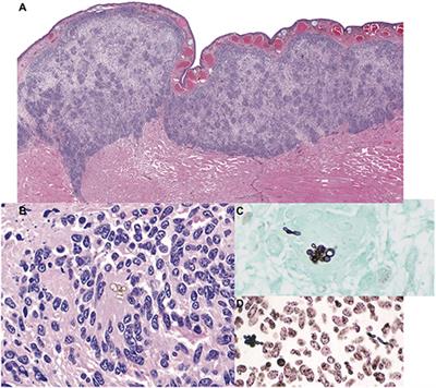 A Novel Exophiala Species Associated With Disseminated Granulomatous Inflammation in a Captive Eastern Hellbender (Cryptobranchus alleganiensis alleganiensis)